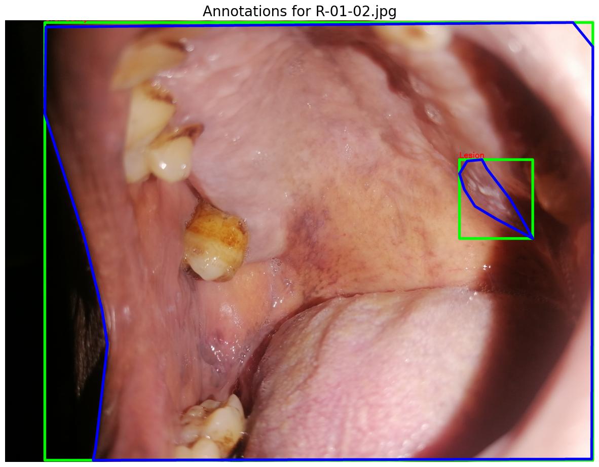 Oral Health Image Classification Pipeline
